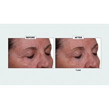 Nakery Beauty 2-pack Lift-TOX 360 Firming Eye Lift Treatment