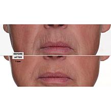 Nakery Beauty 2-pack Rapid Lift Multi-Peptide Serum