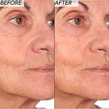 Nakery Beauty 2-Piece Supersize Firm + Lift Collection - Auto-Ship®