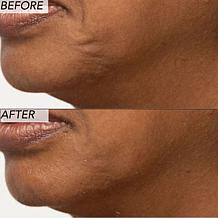 Nakery Beauty 2-Piece Supersize Firm + Lift Collection - Auto-Ship®