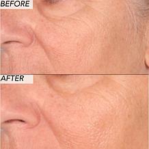 Nakery Beauty 2-Piece Supersize Firm + Lift Collection