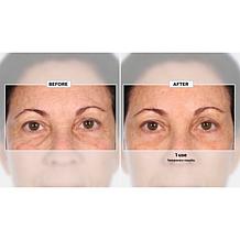 Nakery Beauty Advanced Instant Wrinkle Eraser Auto-Ship®