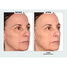 Nakery Beauty Advanced Instant Wrinkle Eraser
