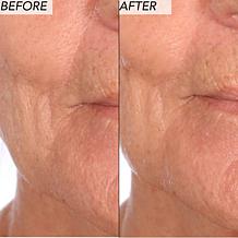 Nakery Beauty Advanced Resurfacing Microderm Scrub