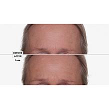 Nakery Beauty Double Retinol & Collagen Peptide Serum Treatment