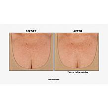 Nakery Beauty Firm + Wrinkle-Reducing Neck + Dec Serum Auto-Ship®