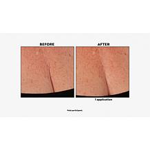 Nakery Beauty Firm + Wrinkle-Reducing Neck + Dec Serum Auto-Ship®