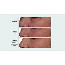 Nakery Beauty Lift-TOX 360 Firming Eye Lift Treatment Cream Auto-Ship®