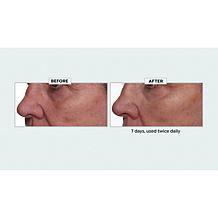 Nakery Beauty Lift-TOX 360 Firming Eye Lift Treatment Cream