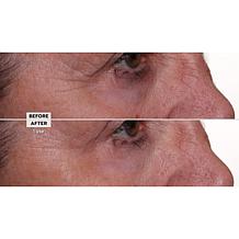 Nakery Beauty Lift-TOX 360 Firming Eye Lift Treatment Cream