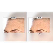 Nakery Beauty Peptide-Surge Intense Collagen Concentrate
