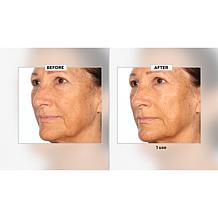 Nakery Beauty Peptide-Surge Intense Collagen Concentrate Auto-Ship®