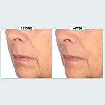 Nakery Beauty SkinRecovery Make it Vanish Power Cream w/Erase Complex