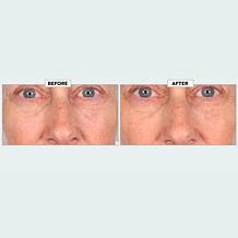 Nakery Beauty SkinRecovery Night Shift Concentrate