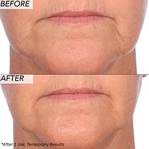 Nakery Beauty SkinRecovery The Age Edit TimeErasing Serum - Auto-Ship®