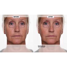 Nakery Beauty SkinRepair Retinol Deep Wrinkle Serum Auto-Ship®