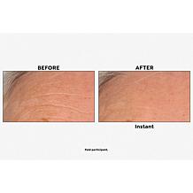 Nakery Beauty Skip the Line Instant Wrinkle Eraser