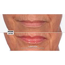 NassifMD 2-pack Pink Champagne Hydro-Screen for Lips Lip Plumper