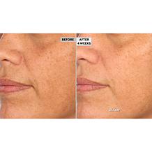 NassifMD 2-pc Best Sellers Set with Glycolic Polish Sample Auto-Ship®