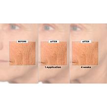 NassifMD 2-piece Best Sellers Set with Glycolic Polish Sample
