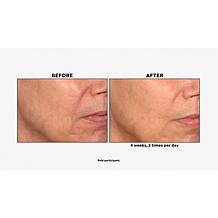 NassifMD 2-piece Dawn to Dusk Cleanser and Hydro-Gel Serum Set