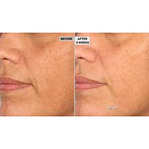 NassifMD 4-Piece Clean + Prep + Treat + Hydrate Skin Reset System