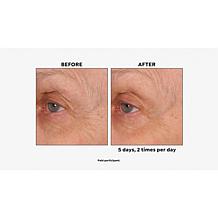 NassifMD® Age Defying Eye Renewal Serum with Dual Action Peptides
