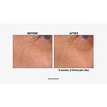 NassifMD® Age Defying Eye Renewal Serum with Dual Action Peptides