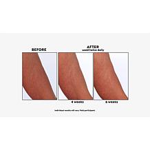 NassifMD® Crepe Inhibitor Triple Action Body Butter