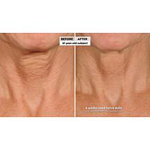 NassifMD® Deco-Lift Neck Firming Complex Serum Duo