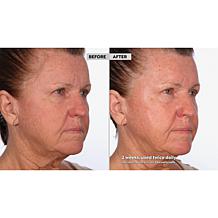 NassifMD® Detox Pads and Hydro-Screen® Face & Body Souffle Auto-Ship®