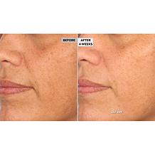 NassifMD Detox Pads and Hydro-Screen On-the-Go Set
