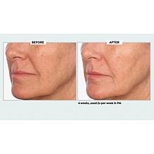 NassifMD Even & Correct Retexturizing Pads Home & Go Kit Auto-Ship®