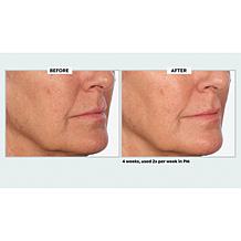 NassifMD Even, Correct & Renew Retexturizing Pads