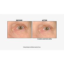 NassifMD Eye and Neck Targeted Peptide Try-Me 2-piece Set