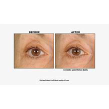 NassifMD Eye and Neck Targeted Peptide Try-Me 2-piece Set