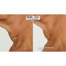 NassifMD Eye and Neck Targeted Peptide Try-Me 2-piece Set