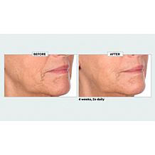 NassifMD Home and Go Niacinamide Biopeptide Serums