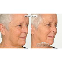 NassifMD® Hydro-Screen Hydrating Serum - Deluxe Size