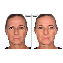 NassifMD® Hydro-Screen Hydrating Serum - Deluxe Size