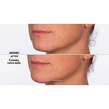 NassifMD® Hydro-Screen Hydrating Serum - Deluxe Size