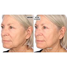 NassifMD Hydro-Screen Hydrating Serum Home & Go 2-piece Set Auto-Ship®