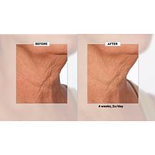 NassifMD Neck & Decollete Upfinity Peptide Complex Serum Auto-Ship®