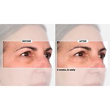 NassifMD Niacinamide Biopeptide Smoothing Serum