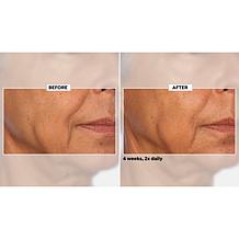 NassifMD Niacinamide Smoothing Serum Auto-Ship®