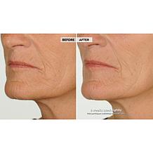 NassifMD Night Therapy Serum with Vitamin C & Retinol