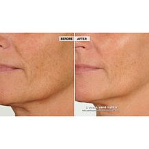 NassifMD Night Therapy Serum with Vitamin C & Retinol
