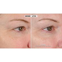 NassifMD® Peri-Orbital Eye Complex