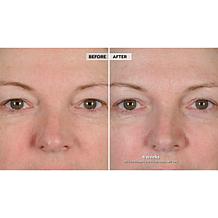 NassifMD® Peri-Orbital Eye Complex