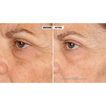 NassifMD® Peri Orbital Eye Complex Duo